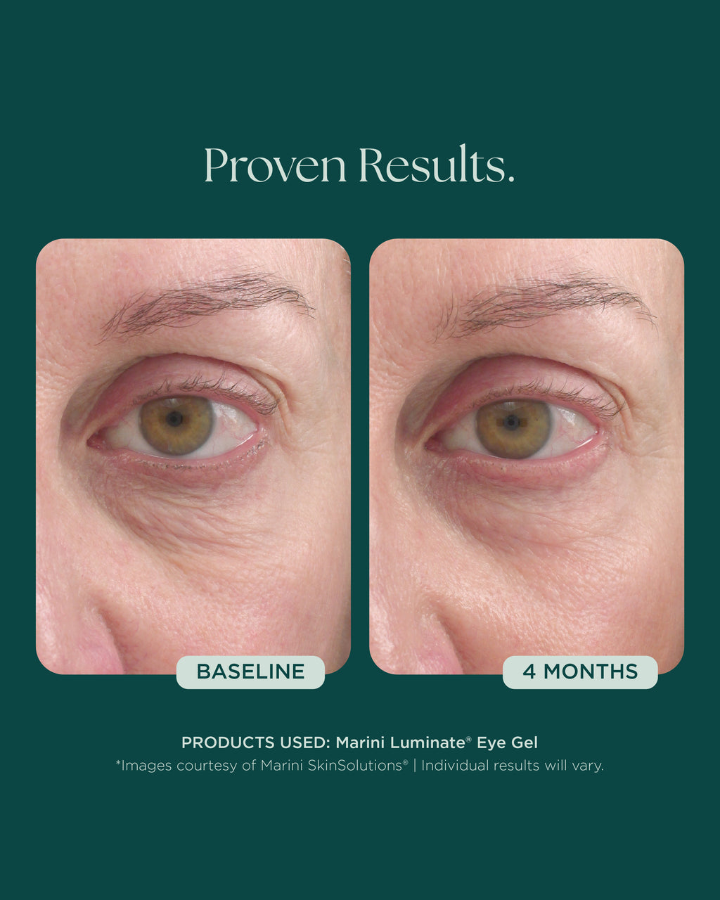 Marini Luminate Eye Gel