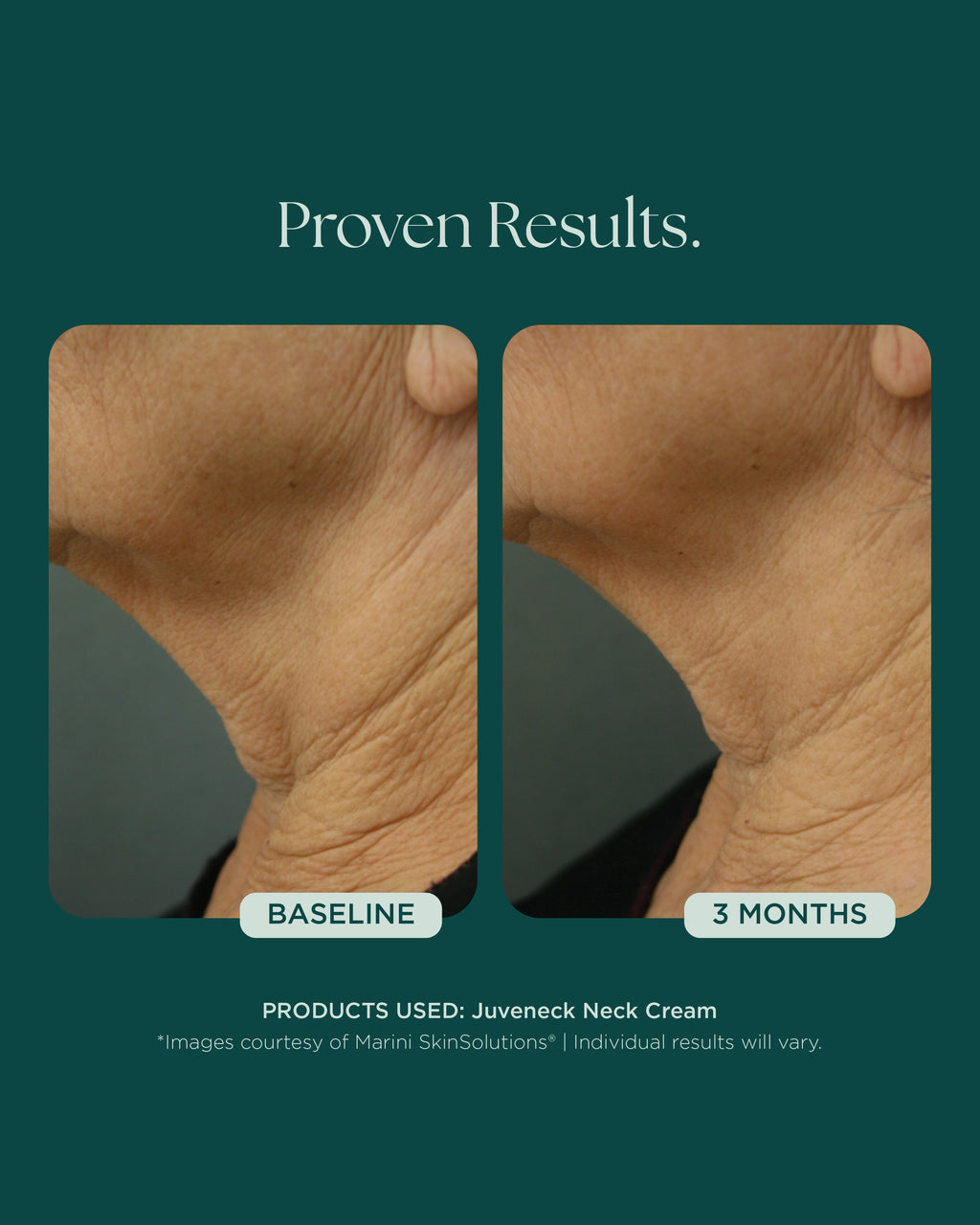 Marini Juve Neck Cream
